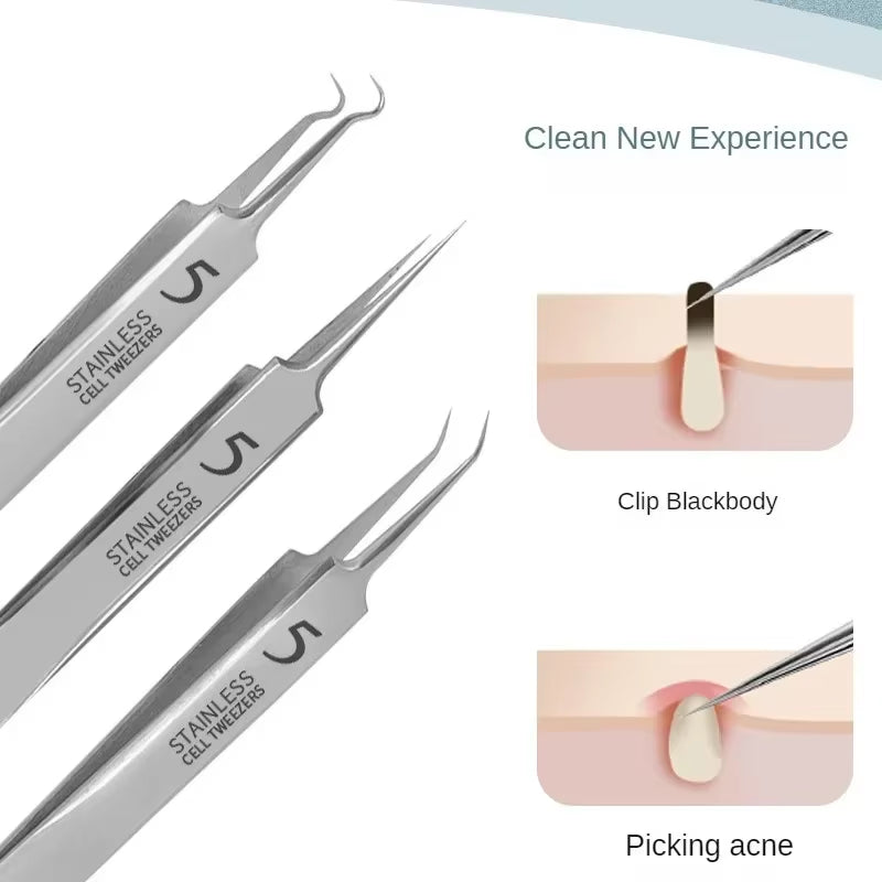Ultimate Acne & Blackhead Remover Kit - 11 Pcs Ultra-Fine Tweezers & Extractors for Flawless Skin